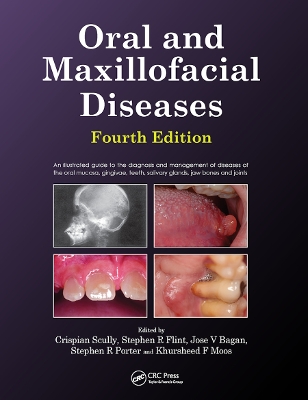 Oral and Maxillofacial Diseases, Fourth Edition book