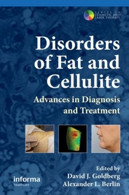 Disorders of Fat and Cellulite book