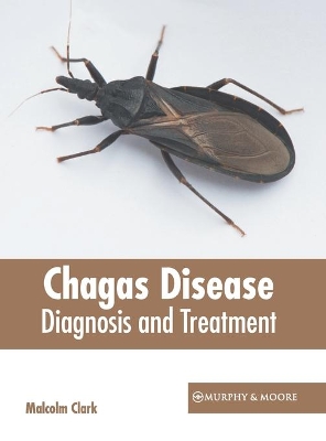 Chagas Disease: Diagnosis and Treatment book