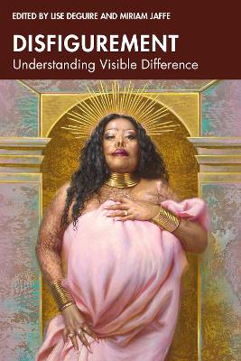 Disfigurement: Understanding Visible Difference by Lise Deguire