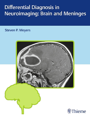 Differential Diagnosis in Neuroimaging: Brain and Meninges book