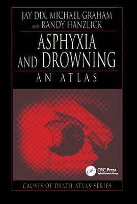 Asphyxia and Drowning by Jay Dix