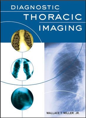 Diagnostic Thoracic Imaging book