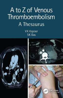 A to Z of Venous Thromboembolism: A Thesaurus by VK Kapoor