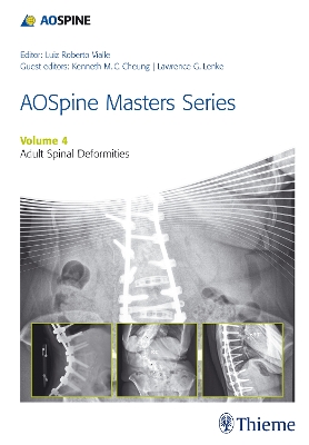 AOSpine Master Series, Vol. 4: Adult Spinal Deformities book