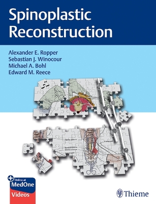 Spinoplastic Reconstruction book