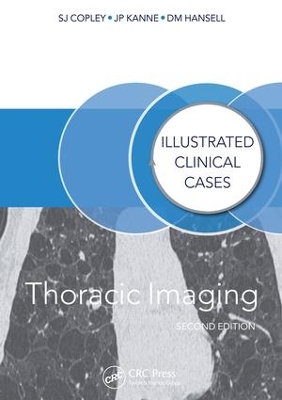 Thoracic Imaging: Illustrated Clinical Cases, Second Edition by Sue Copley