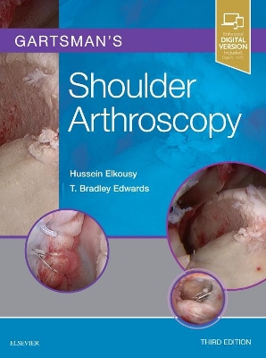 Gartsman's Shoulder Arthroscopy book