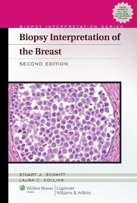 Biopsy Interpretation of the Breast book