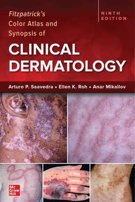 Fitzpatrick's Color Atlas and Synopsis of Clinical Dermatology, Ninth Edition book