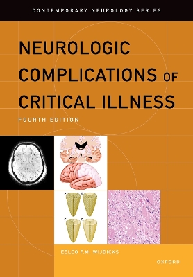 Neurologic Complications of Critical Illness book