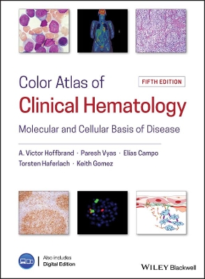 Color Atlas of Clinical Hematology: Molecular and Cellular Basis of Disease by A. Victor Hoffbrand