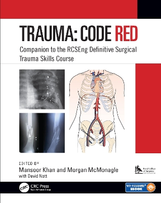 Trauma: Code Red: Companion to the RCSEng Definitive Surgical Trauma Skills Course by Mansoor Khan