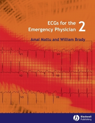 Ecgs for the Emergency Physician 2E book
