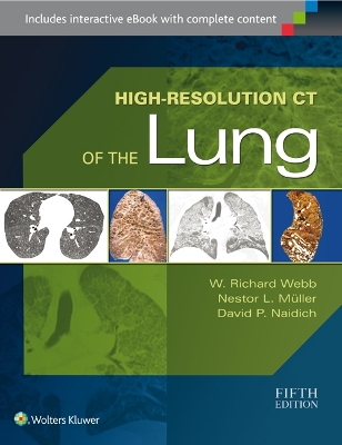 High-Resolution CT of the Lung book