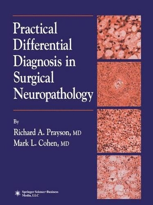Practical Differential Diagnosis in Surgical Neuropathology book