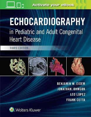 Echocardiography in Pediatric and Adult Congenital Heart Disease by Benjamin W. Eidem