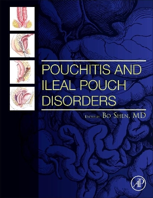 Pouchitis and Ileal Pouch Disorders: A Multidisciplinary Approach for Diagnosis and Management book