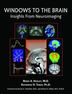 Windows to the Brain book