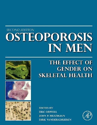 Osteoporosis in Men book