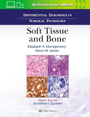 Differential Diagnoses in Surgical Pathology: Soft Tissue and Bone book