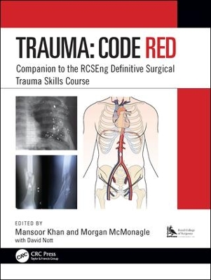 Trauma: Code Red: Companion to the RCSEng Definitive Surgical Trauma Skills Course book