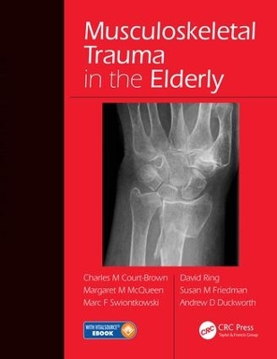 Musculoskeletal Trauma in the Elderly by Charles Court-Brown