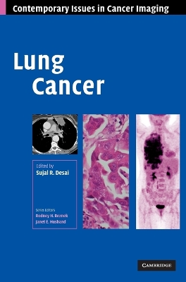 Lung Cancer book