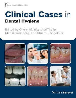 Clinical Cases in Dental Hygiene book