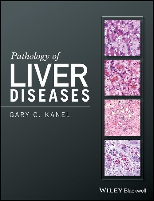 Pathology of Liver Diseases book