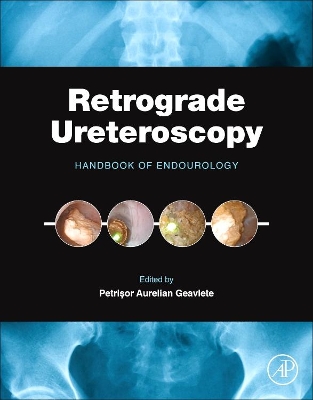 Retrograde Ureteroscopy book
