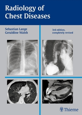 Radiology of Chest Diseases by Sebastian Lange