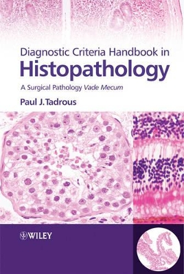 Diagnostic Criteria Handbook in Histopathology - a Surgical Pathology Vade Mecum book