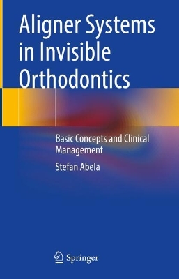 Aligner Systems in Invisible Orthodontics: Basic Concepts and Clinical Management book