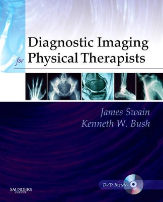 Diagnostic Imaging for Physical Therapists by James Swain