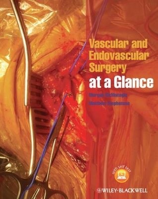 Vascular and Endovascular Surgery at a Glance book