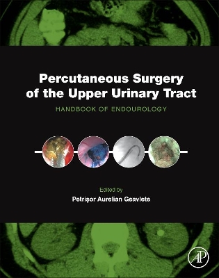 Percutaneous Surgery of the Upper Urinary Tract book