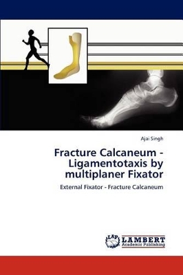 Fracture Calcaneum - Ligamentotaxis by multiplaner Fixator book