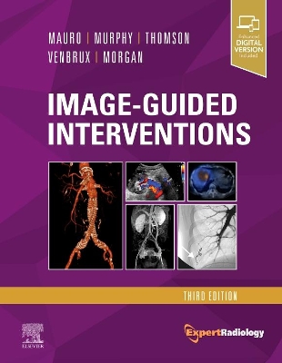 Image-Guided Interventions: Expert Radiology Series by Matthew A. Mauro