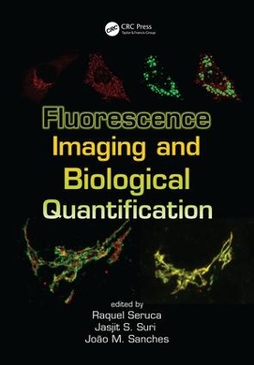 Fluorescence Imaging and Biological Quantification by Raquel Seruca