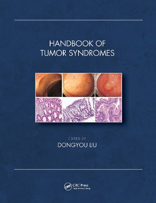 Handbook of Tumor Syndromes by Dongyou Liu