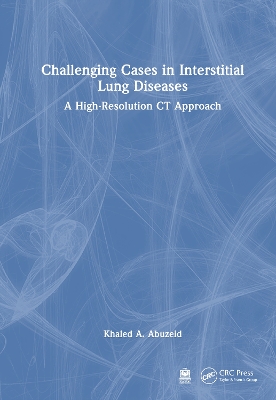 Challenging Cases in Interstitial Lung Diseases: A High-Resolution CT Approach book