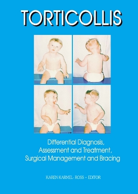 Torticollis: Differential Diagnosis, Assessment and Treatment, Surgical Management and Bracing by Karen Karmel-Ross