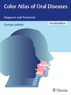 Color Atlas of Oral Diseases book
