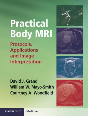 Practical Body MRI book