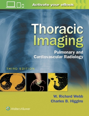 Thoracic Imaging book