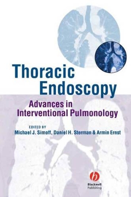 Thoracic Endoscopy book