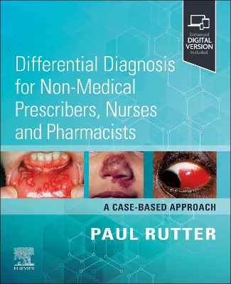 Differential Diagnosis for Non-medical Prescribers, Nurses and Pharmacists: A Case-Based Approach book