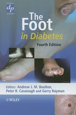 Foot in Diabetes book