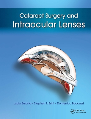 Cataract Surgery and Intraocular Lenses by Lucio Buratto